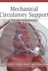 Mechanical Circulatory Support: Principles and Applications (English Edition)