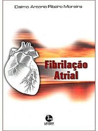 Fibrilao Atrial