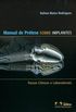 Manual de Prtese sobre Implantes