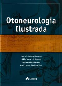 Otoneurologia Ilustrada