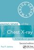 Making Sense of the Chest X-ray: A hands-on guide (English Edition)