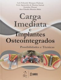 Carga Imediata e Implantes Osteointegrados: Possibilidades e Tcnicas